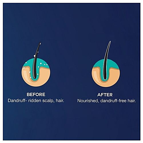 Parachute Advansed Men Hair Cream - Anti-Dandruff, 50 g Cocolipid Formula