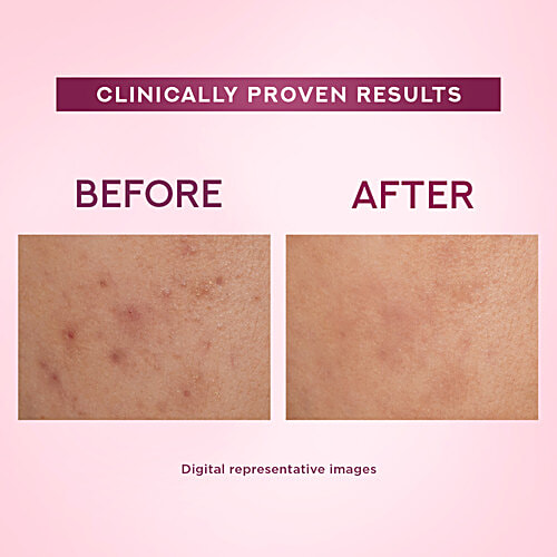 Ponds Bright Beauty Light Cream With UV Filter & Niasorcinol, 24 g  