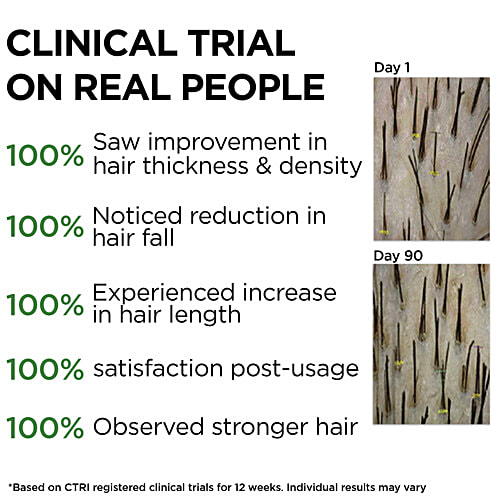 Soulflower Castor Hair Oil For Growth - Hydrates Skin, Clinically Proven, 225 ml  Pure & Natural