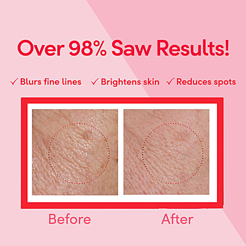 Ponds Age Miracle Wrinkle Corrector Night Cream, 50 g  