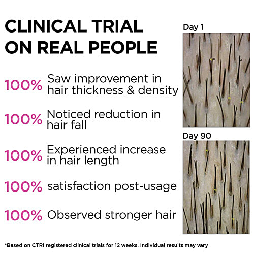 Soulflower Rosemary Essential Oil - For Hair Fall Control & Growth, Clinically Proven, 30 ml  Natural Haircare