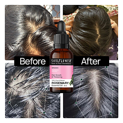 Soulflower Rosemary Essential Oil - For Hair Fall Control & Growth, Clinically Proven, 30 ml  Natural Haircare