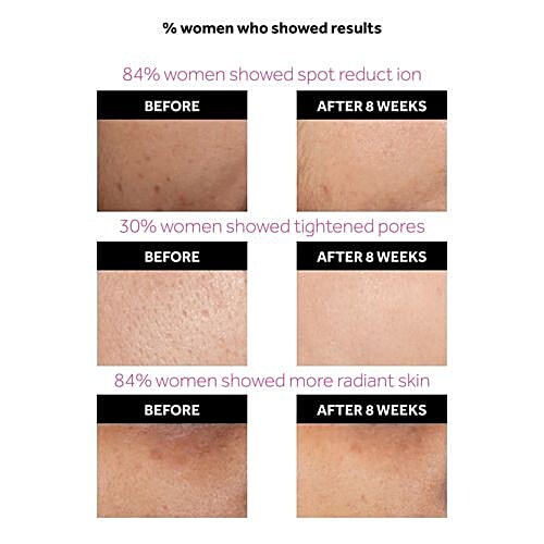 Ponds Flawless Radiance Derma+ Moisturising Day Cream SPF 30 PA+++, 50 g  