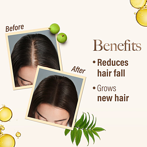 Kesh King Ayurvedic Hair Oil For New Hair Growth, Reduces Hairfall, Suitable For Men & Women, 200 ml Bottle Contains 21 Ayurvedic Herbs, With Bhringraja, Amla, Brahmi & 21 Natural Ingredients