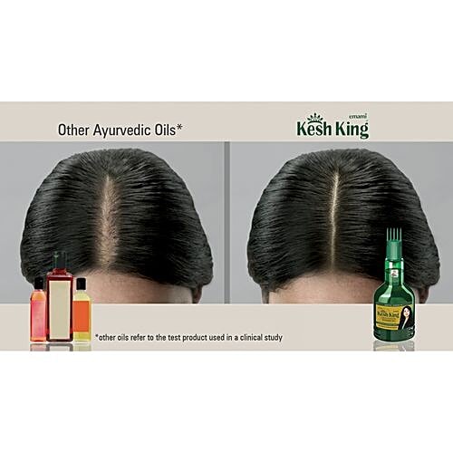 Kesh King Ayurvedic Hair Oil For New Hair Growth, Reduces Hairfall, Suitable For Men & Women, 100 ml Bottle Contains 21 Ayurvedic Herbs, With Bhringraja, Amla, Brahmi & 21 Natural Ingredients