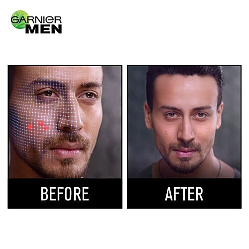 Garnier Men Acno Fight Pimple Clearing Gel, 10 ml  