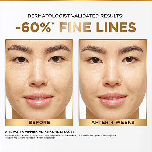 L'Oreal Paris Revitalift - 1.5% Hyaluronic Acid Serum, 15 ml Bottle 