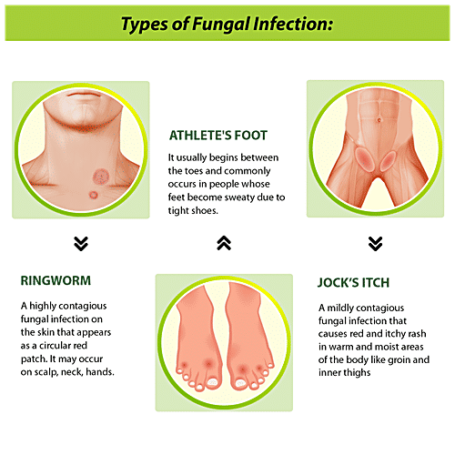 Tetmosol Dusting Powder - Anti-Fungal, Controls Itching, Fights Skin Infection & Prickly Heat, 100 g  