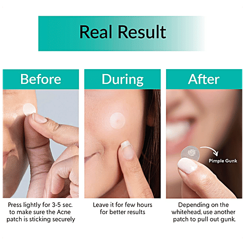 PRIVEDA Spot Clearing Dots - Acne Pimple Patch, Great For Day & Night Use, Drug-free & Non-drying, 57 pcs  