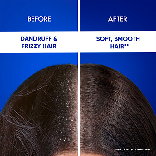 Head & Shoulders 2-in-1 Anti-Dandruff Shampoo + Conditioner - For Women & Men, Anti-Hairfall, Reduces Breakage, 650 ml Bottle 