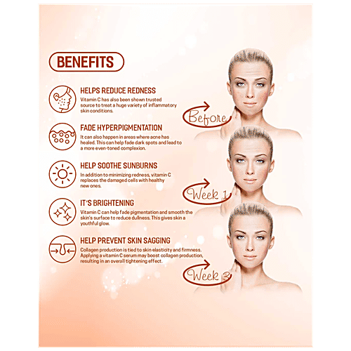 Spantra Vitamin C Facial Serum - Brightens, Healthier Skin, With Hyaluronic Acid, 50 ml  