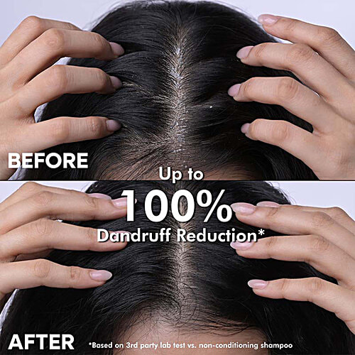 Naturali Dandruff Defence Shampoo - Moisturises, Scalp & Hair, 200 ml  