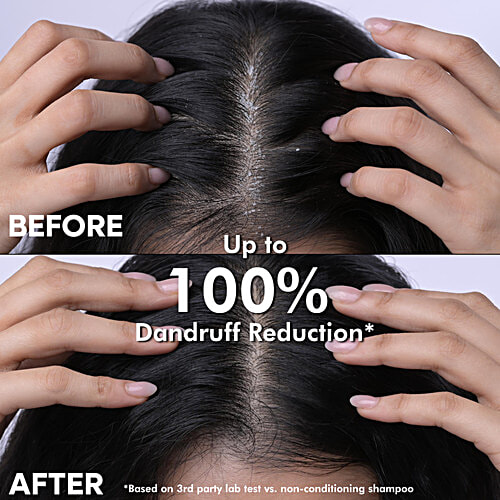 Naturali Dandruff Defence Shampoo - Moisturises, Scalp & Hair, 340 ml  