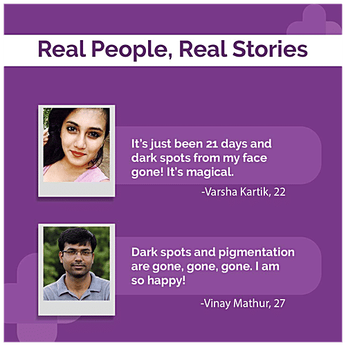 The Derma Co 2% Kojic Acid Face Cream - With Vitamin C & Glycolic Acid, For Pigmentation, 30 g  