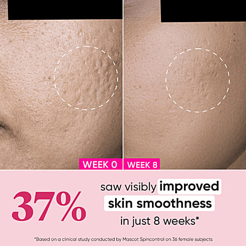 Dot & Key Night Reset Retinol + Ceramide Sleep Treatment Cream - For Firmer & Youthful Skin, 60 ml  