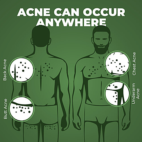 Beardo B-Acne Clear Body Wash - Purifies Skin & Calms Acne, Anti-Bacterial, For Men, 200 ml