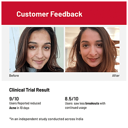 Chemist At Play Acne Control Face Serum - Cleans Pores, Reduces Breakouts, 30 ml