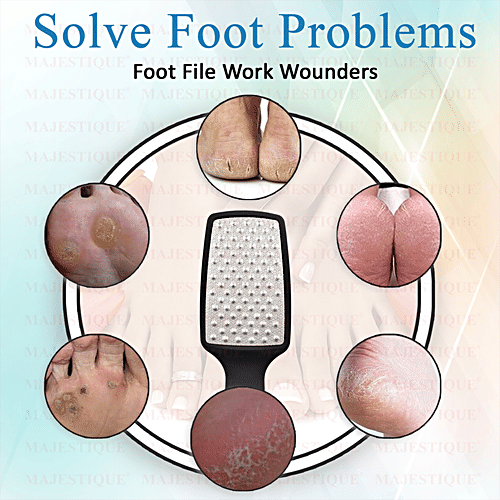 Majestique Foot Scrubber With Handle - With Comfortable Grip, Callus Remover, For Pedicure, 1 pc