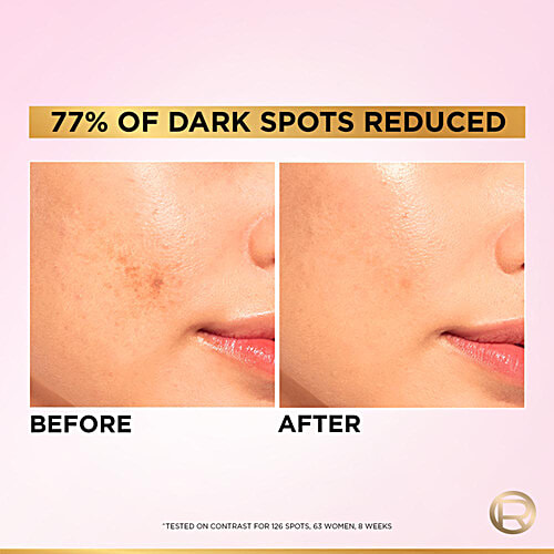 L'Oreal Paris Glycolic Bright 8% [Melasyl + Niacinamide] Face Serum for Brightening Dark Spots, 15 ml  Glycolic Bright 8% Melasyl + Glycolic + Niacinamide Face Serum For Dark Spot & Brightening