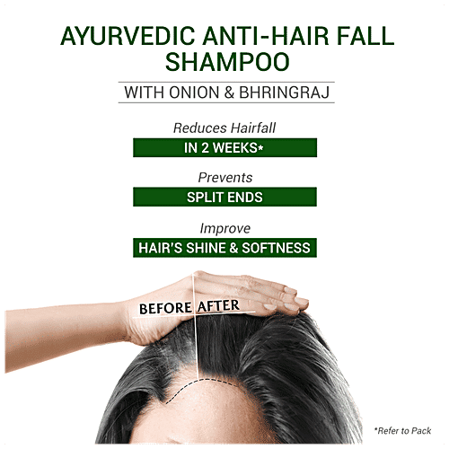 Sesa Ayurvedic Anti-Hair Fall Onion Shampoo - Bhringraj, Onion & 6 Ayurvedic Herbs, Control Hair Fall In 2 Weeks, 500 ml Bottle 