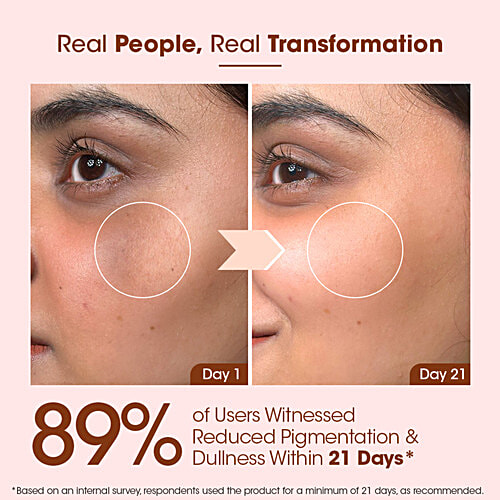 TAC - The Ayurveda Co. 10% Kumkumadi Day Cream With SPF 20, 50 g  For Radiant & Youthful Skin