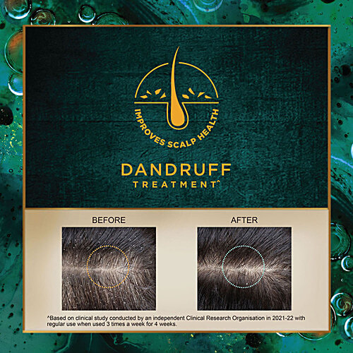 Indulekha Svetakutaja Oil - Ayurvedic Medicinal Oil For Dandruff Treatment, 50 ml  