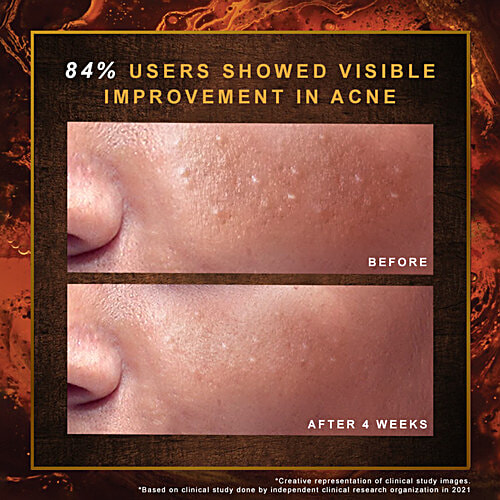 Indulekha Ayurvedic Proprietary Medicine Soap - For Dark Spots & Marks, 100 g (Pack of 3) Helps With Uneven Skin Tone, Repairs Visible Signs Of Skin Damage In 4 Weeks