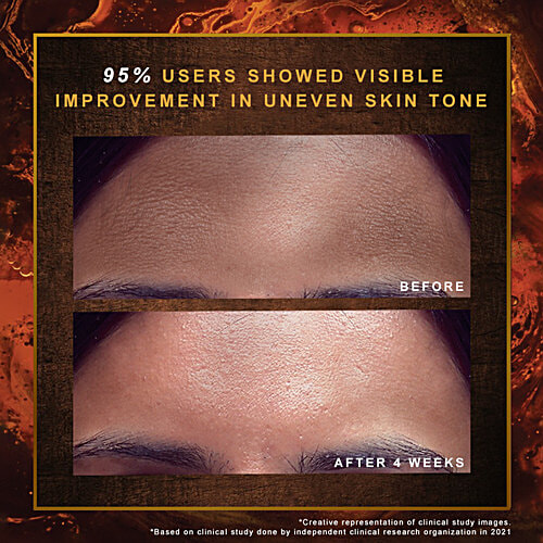 Indulekha Ayurvedic Proprietary Medicine Soap - For Dark Spots & Marks, 100 g (Pack of 3) Helps With Uneven Skin Tone, Repairs Visible Signs Of Skin Damage In 4 Weeks