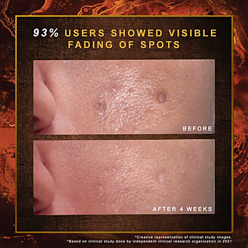 Indulekha Ayurvedic Proprietary Medicine Soap - For Dark Spots & Marks, 100 g (Pack of 3) Helps With Uneven Skin Tone, Repairs Visible Signs Of Skin Damage In 4 Weeks