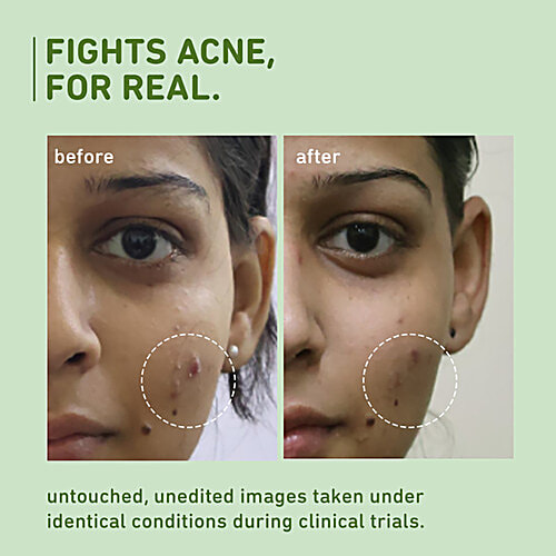 Plum Green Tea Pore Cleansing Face Wash - With Glycolic Acid, 100 ml  Fights Pimples, Controls Oil