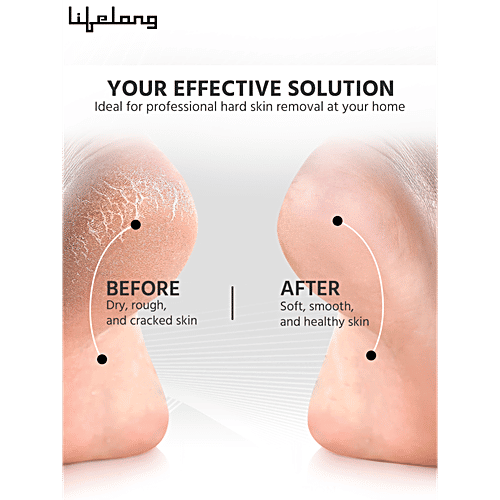 Lifelong Callus Remover - With USB Charging, Foot Scrubber, White, LLPCW104, 1 pc For Feet and Heel, Portable Electronic Foot File Pedicure Tools, Dead Skin Removal device