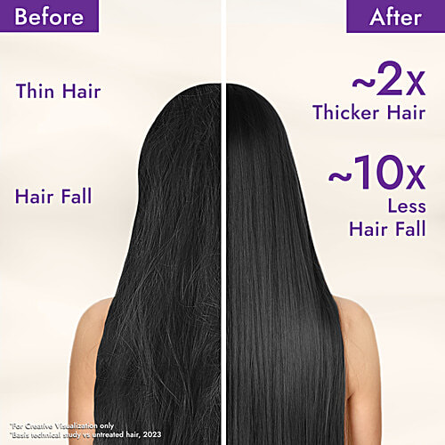 Parachute Advansed Rosemary Enriched Coconut Hair Oil, 300 ml  