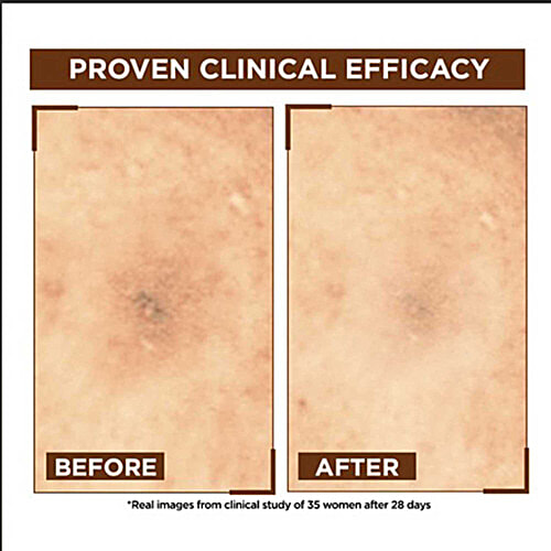 Garnier Bright Complete Overnight Booster Serum - 10% Pure Vitamin C, 15 ml  