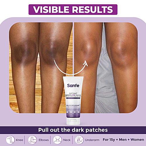 Sanfe Instant Spotlite Mask For Dark Underarm, Neck & Body, 2.5% Kojic Acid & 3.1% Glycolic Acid, 100 g  