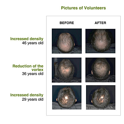 Soulflower Rosemary Redensyl Hair Growth Serum - Anti-Greying Booster, 30 ml Boost hair Growth & Reduce thinning, Long Lasting Advanced Formula