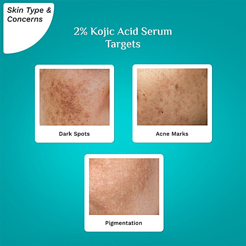 Pilgrim 2% Kojic Acid Serum - With 1% Alpha Arbutin & Korean White Lotus, 30 ml  For Dark Spots & Pigmentation, Fragrance-Free