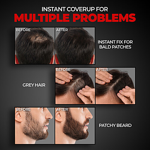 Beardo Blackout Powder Cover Up For Hair Problems - For Grey Roots, Patchy Beard & Thinning Hairline, 4 g  Beard Patches & Bald Spots, Highly Pigmented, Long-Lasting & Matte Finish, Super-Fine Cover-up Powder