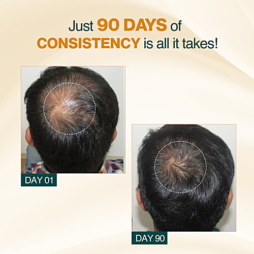 Nourish Mantra Advanced Hair Growth Serum - With Rosemary Extract, 25 ml  