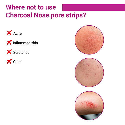 Sotrue Nose Pore Strips - Deep Cleansing Charcoal, 4 pcs