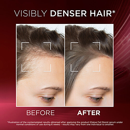 L'Oreal Paris Fall Resist Anti Hair Fall Serum With 1.5% Aminexil, Caffeine & Arginine, 102 ml  For Lesser Hair Fall, For Lesser Visible Scalp & Hair Fall