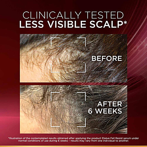 L'Oreal Paris Fall Resist Anti Hair Fall Serum With 1.5% Aminexil, Caffeine & Arginine, 102 ml  For Lesser Hair Fall, For Lesser Visible Scalp & Hair Fall