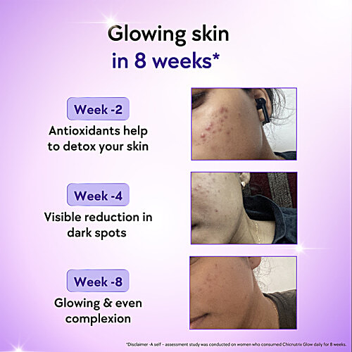 Chicnutrix Glow Glutathione Strawberry & Lemon Flavour Effervescent Tablets, 10 pcs  Vit C