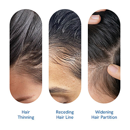 Be Bodywise Hair Growth Serum Roll-On, 25 ml  No Side Effects