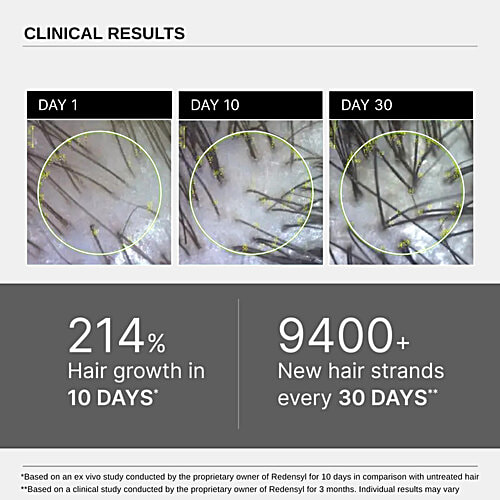 Bare Anatomy Advanced Hair Growth Serum, 30 ml