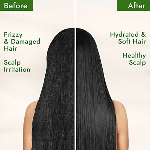 Parachute Advansed Aloe Vera Enriched Coconut Hair Oil With Green Tree Extract, 300 ml  For Hydrated & Soft Hair, No Silicones, Dermatologically Tested