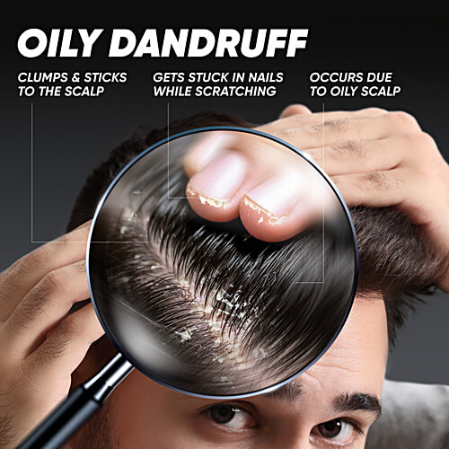 Head & Shoulders Deep Cleanse Anti-Dandruff Shampoo With Oxygenated Charcoal, 340 ml For Oily Scalp